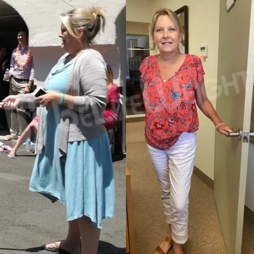 Karen R - 2 Year Update*